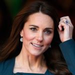 Kate Middleton plastic surgery 8