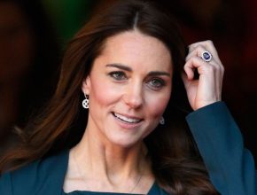 Kate Middleton plastic surgery 8