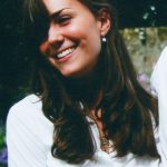 Kate Middleton before plastic surgery 53