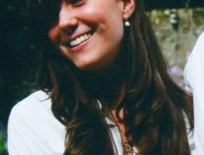 Kate Middleton before plastic surgery 53