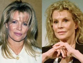 Kim Basinger before and after plastic surgery 10