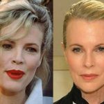 Kim Basinger before and after plastic surgery 6
