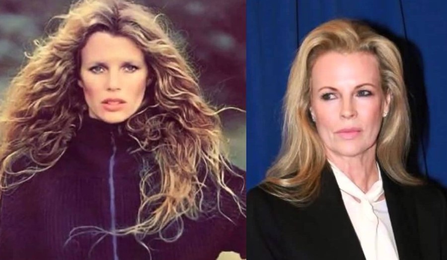 Kim Basinger before and after plastic surgery 