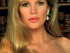 Kim Basinger plastic surgery 19