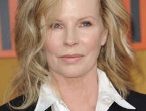 Kim Basinger plastic surgery 22