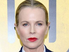 Kim Basinger plastic surgery 23