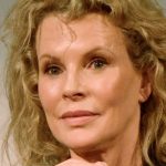 Kim Basinger plastic surgery 32