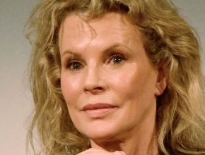 Kim Basinger plastic surgery 32