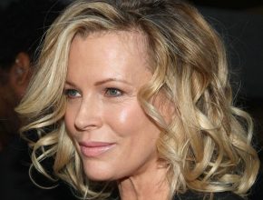 Kim Basinger plastic surgery 33