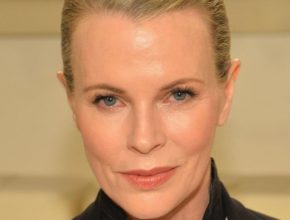 Kim Basinger plastic surgery 8