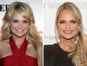 Kristin Chenoweth before and after plastic surgery