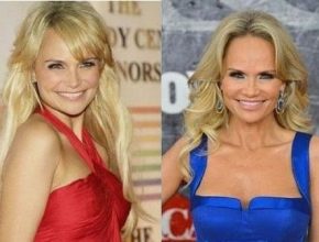 Kristin Chenoweth plastic surgery 14