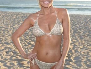 Kristin Chenoweth plastic surgery 20