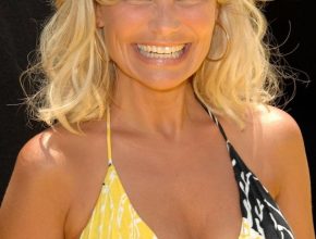 Kristin Chenoweth plastic surgery 23