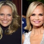 Kristin Chenoweth plastic surgery 4