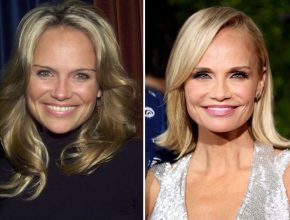 Kristin Chenoweth plastic surgery 4