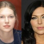 Laura Prepon before and after plastic surgery 2