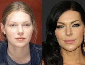 Laura Prepon before and after plastic surgery 2