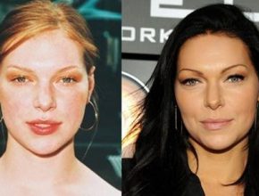 Laura Prepon before and after plastic surgery 3