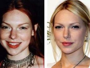 Laura Prepon before and after plastic surgery