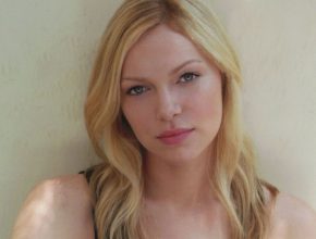 Laura Prepon plastic surgery 33