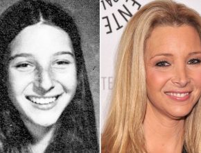 Lisa Kudrow before and after plastic surgery