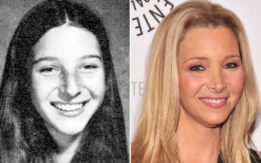 Lisa Kudrow before and after plastic surgery 