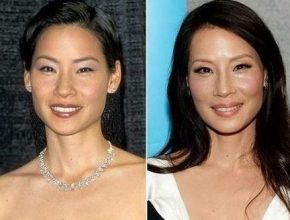 Lucy Liu before and after plastic surgery 2