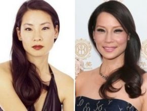 Lucy Liu before and after plastic surgery 3