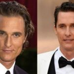 Matthew Mcconaughey before and after plastic surgery