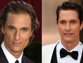 Matthew Mcconaughey before and after plastic surgery