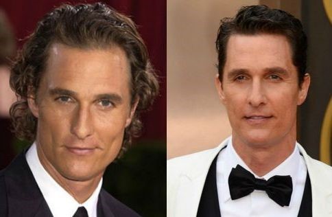 Matthew Mcconaughey before and after plastic surgery 