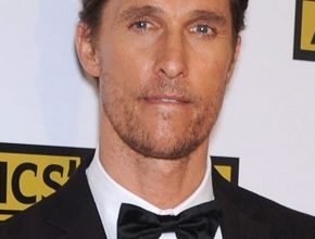 Matthew Mcconaughey plastic surgery 3