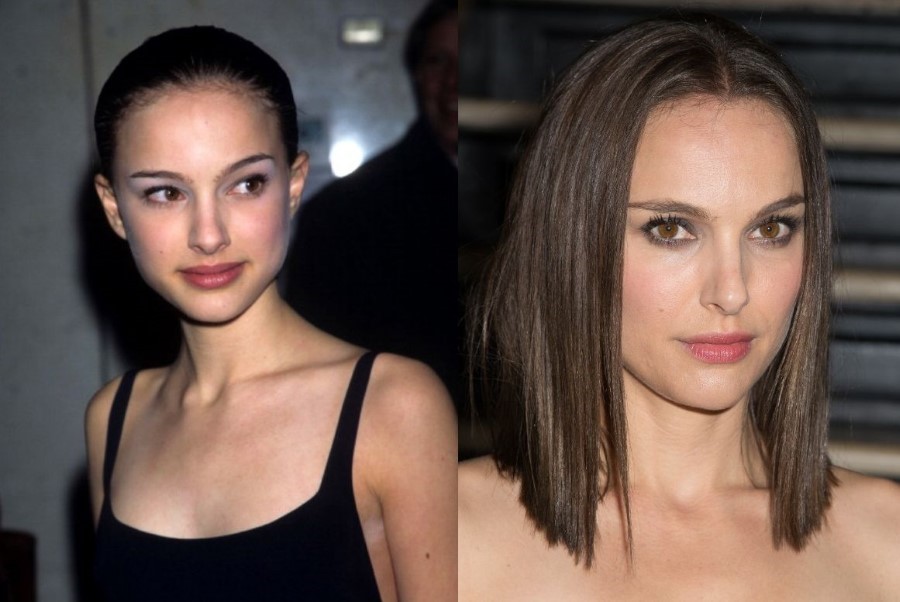 Natalie Portman before and after plastic surgery