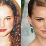 Natalie Portman before and after plastic surgery 33