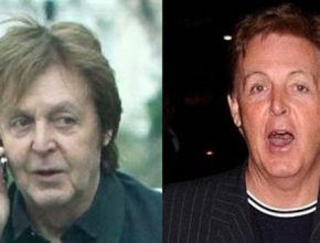 Paul Mccartney before and after plastic surgery 14