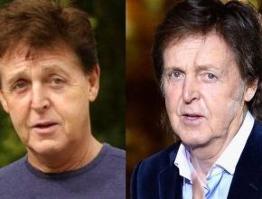 Paul Mccartney before and after plastic surgery 15