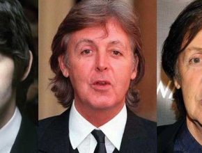 Paul Mccartney plastic surgery 16