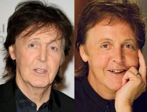 Paul Mccartney before and after plastic surgery