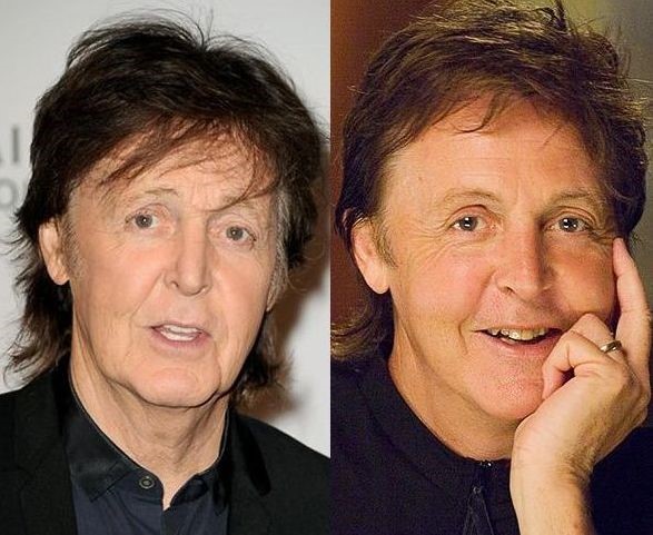 Paul Mccartney before and after plastic surgery 