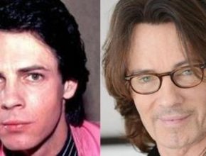 Rick Springfield before and after plastic surgery 1