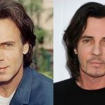 Rick Springfield before and after plastic surgery 3