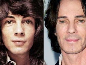 Rick Springfield before and after plastic surgery