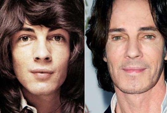 Rick Springfield before and after plastic surgery