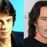 Rick Springfield before and after plastic surgery 7