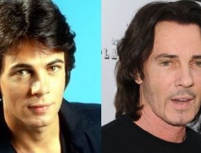Rick Springfield before and after plastic surgery 7