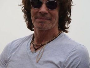 Rick Springfield plastic surgery 10