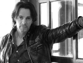 Rick Springfield plastic surgery 25