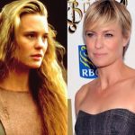 Robin Wright before and after plastic surgery 2