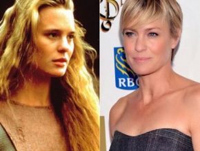 Robin Wright before and after plastic surgery 2